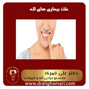 علت بیماری های لثه