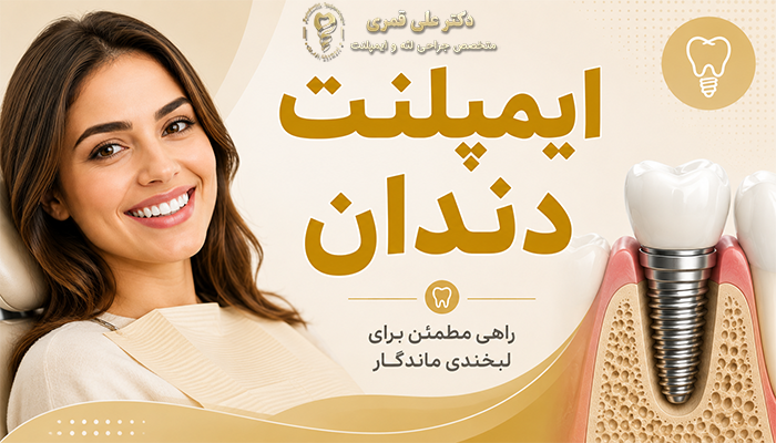 ایمپلنت دندان چیست؟