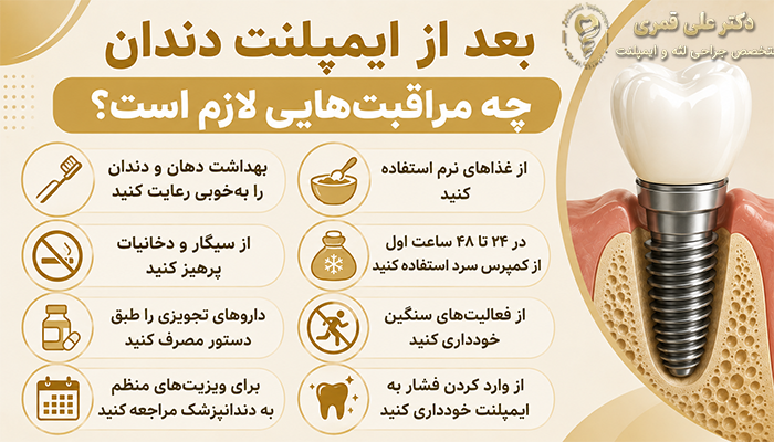 مراقبت های بعد از ایمپلنت دندان