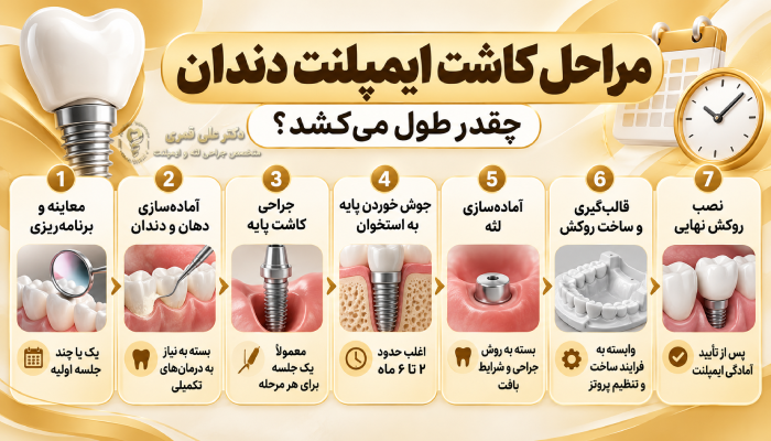 مراحل کاشت ایمپلنت دندان چقدر طول میکشد؟