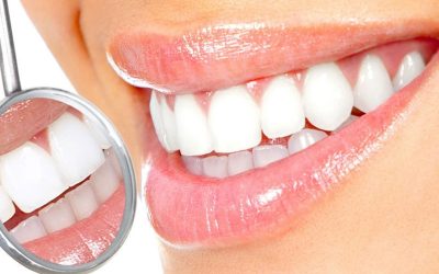 روش های سفید کردن دندان