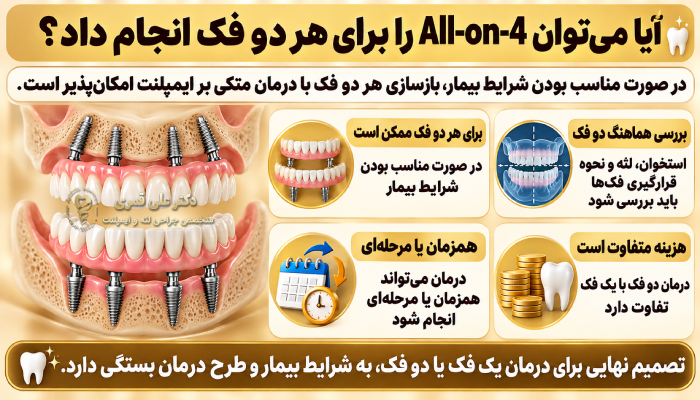 آیا میتوان All-on-4 را برای هر دو فک انجام داد؟