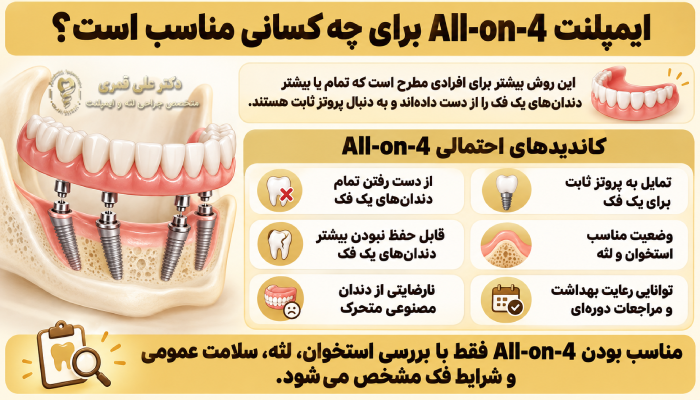 ایمپلنت All-on-4 برای چه کسانی مناسب است؟