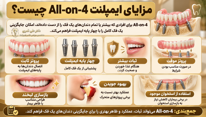مزایای ایمپلنت All-on-4 چیست؟