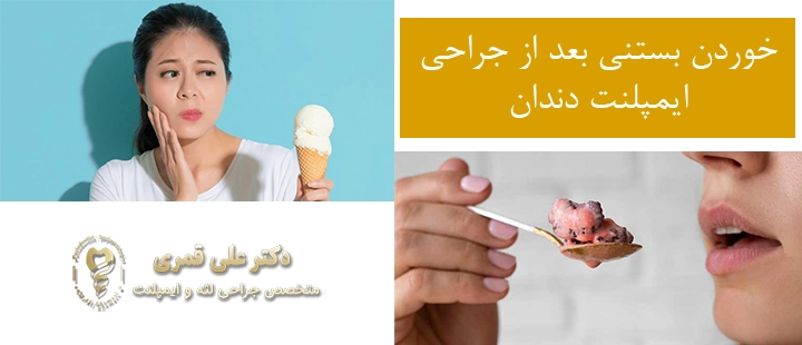 خوردن بستنی بعد از جراحی ایمپلنت دندان