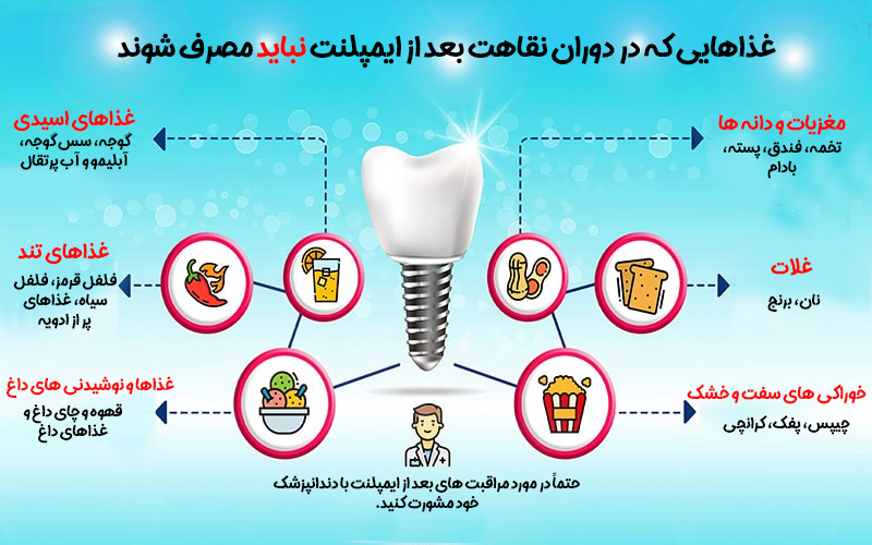 نگهداری صحیح ایمپلنت