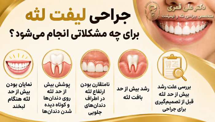 جراحی لیفت لثه برای چه مشکلاتی انجام میشود؟