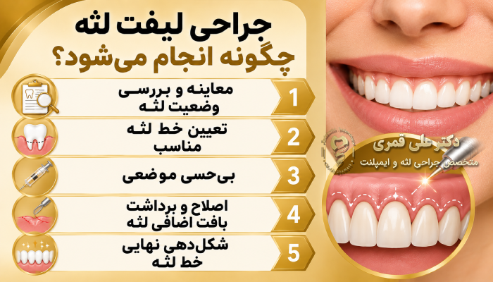 جراحی لیفت لثه چگونه انجام میشود؟