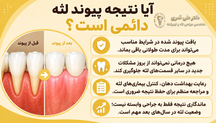 ماندگاری پیوند لثه