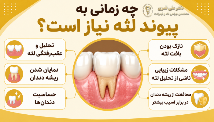 چه زمانی به پیوند لثه نیاز است؟