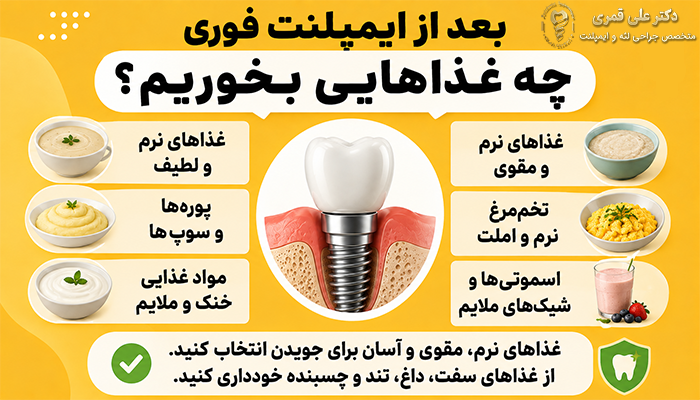 بعد از ایمپلنت فوری چه غذاهایی بخوریم؟