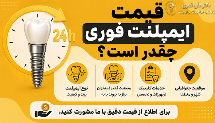 قیمت ایمپلنت فوری چقدر است؟