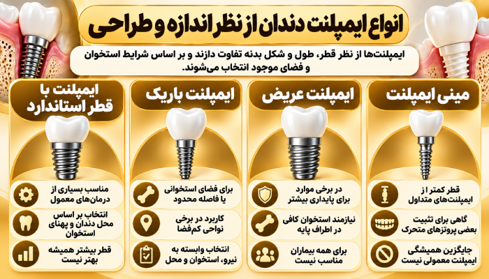 انواع ایمپلنت دندان از نظر اندازه و طراحی