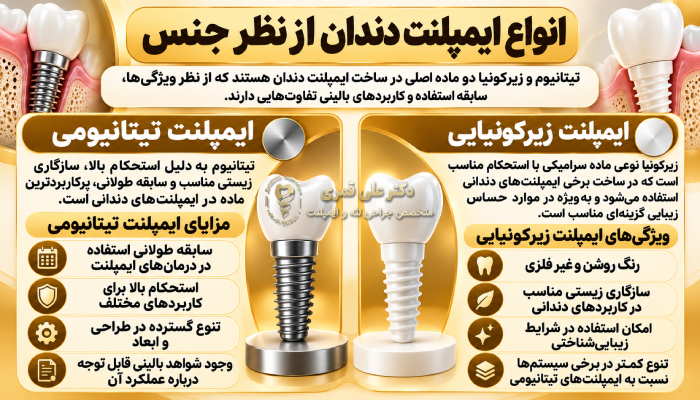 انواع ایمپلنت دندان از نظر جنس