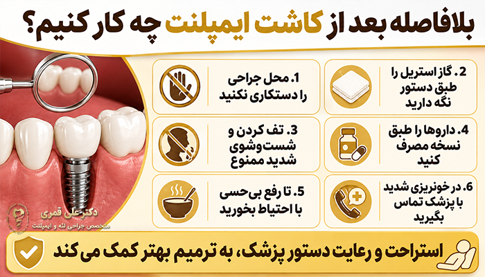 بلافاصله بعد از کاشت ایمپلنت چه کار کنیم؟