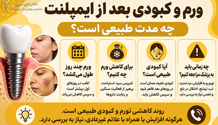ورم و کبودی بعد از ایمپلنت دندان