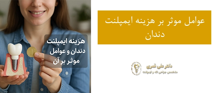 عوامل موثر بر هزینه ایمپلنت دندان 