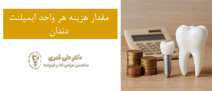 مقدار هزینه هر واحد ایمپلنت دندان 