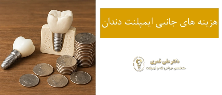 هزینه های جانبی ایمپلنت دندان 