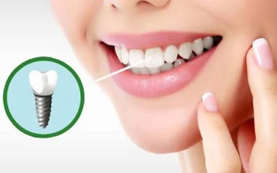 بهترین جراح ایمپلنت دندان؛ چگونه یک انتخاب مطمئن داشته باشیم؟