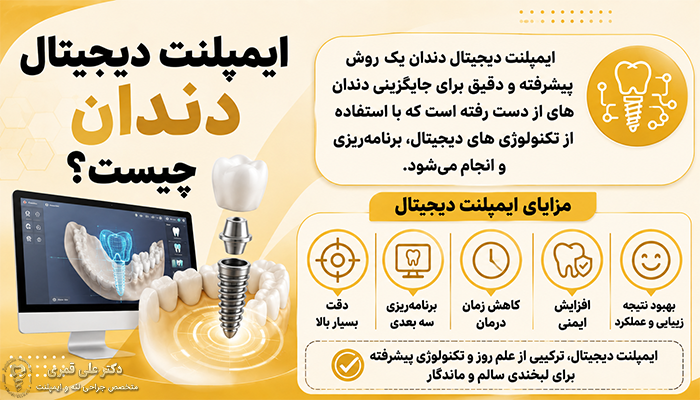 ایمپلنت دیجیتال دندان چیست؟