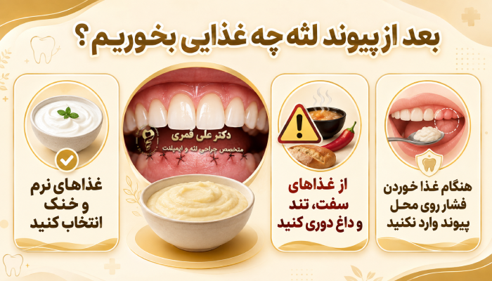 بعد از پیوند لثه چه غذایی بخوریم؟
