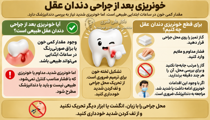 خونریزی بعد از جراحی دندان عقل