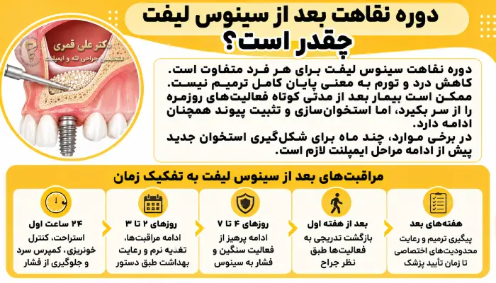دوره نقاهت بعد از سینوس لیفت چقدر است؟
