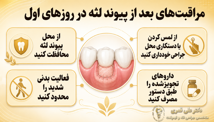 مراقبتهای بعد از پیوند لثه در روزهای اول چگونه است؟