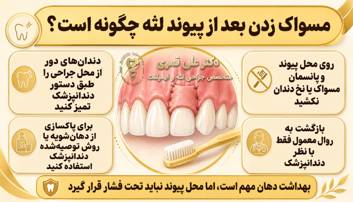 مسواک زدن بعد از پیوند لثه چگونه است؟