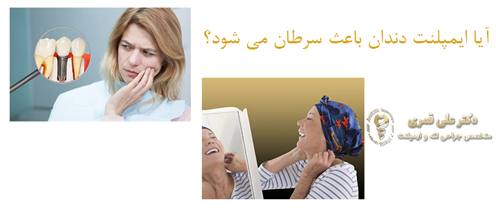 ارتباط بین ایمپلنت و سرطان 