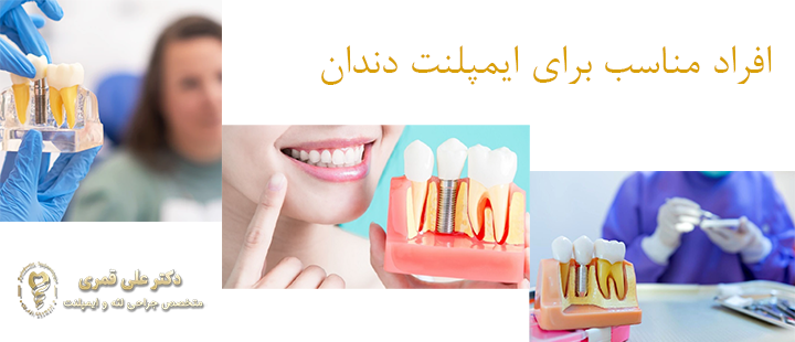درباره افراد مناسب برای ایمپلنت دندان 