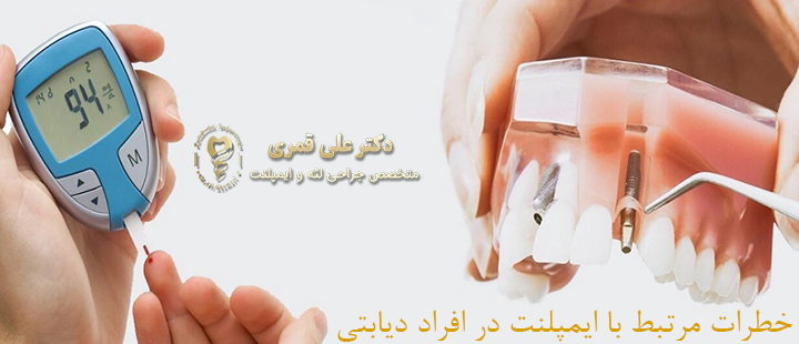 خطرات مرتبط با ایمپلنت در افراد دیابتی