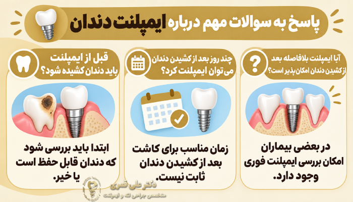 قبل از ایمپلنت باید دندان کشیده شود؟