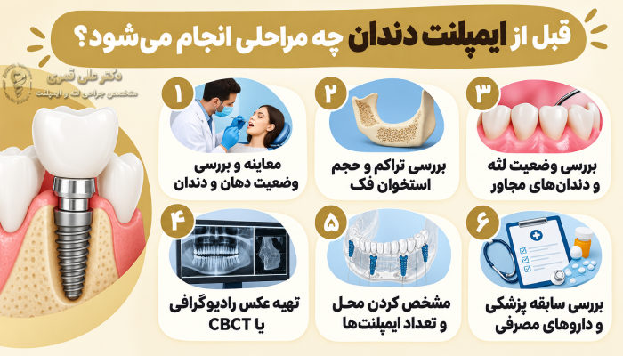 قبل از ایمپلنت دندان چه مراحلی انجام میشود؟