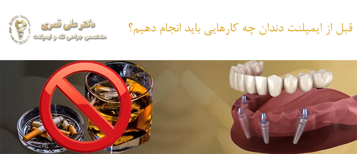 قبل از ایمپلنت دندان چه کارهایی باید انجام دهیم؟
