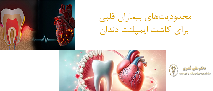 محدودیت‌های بیماران قلبی برای کاشت ایمپلنت دندان