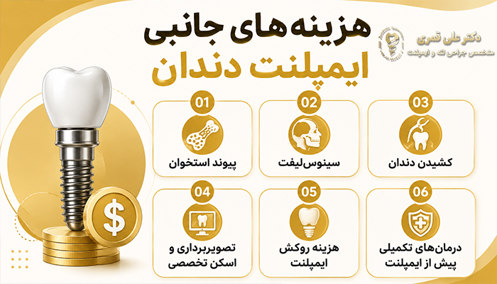 هزینههای جانبی ایمپلنت دندان