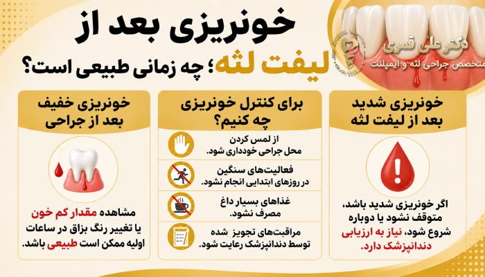 خونریزی بعد از لیفت لثه؛ چه زمانی طبیعی است؟